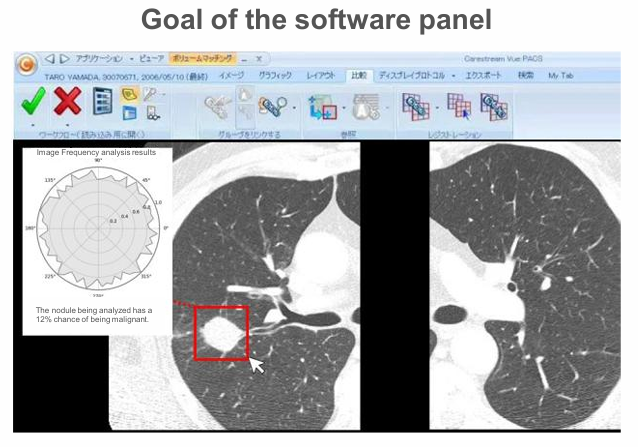Medical image analysis method and program