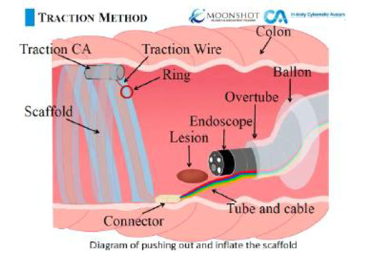 Lithium Extraction from Ore