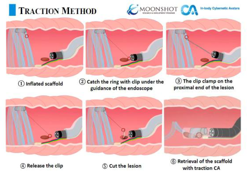 Lithium Extraction from Ore